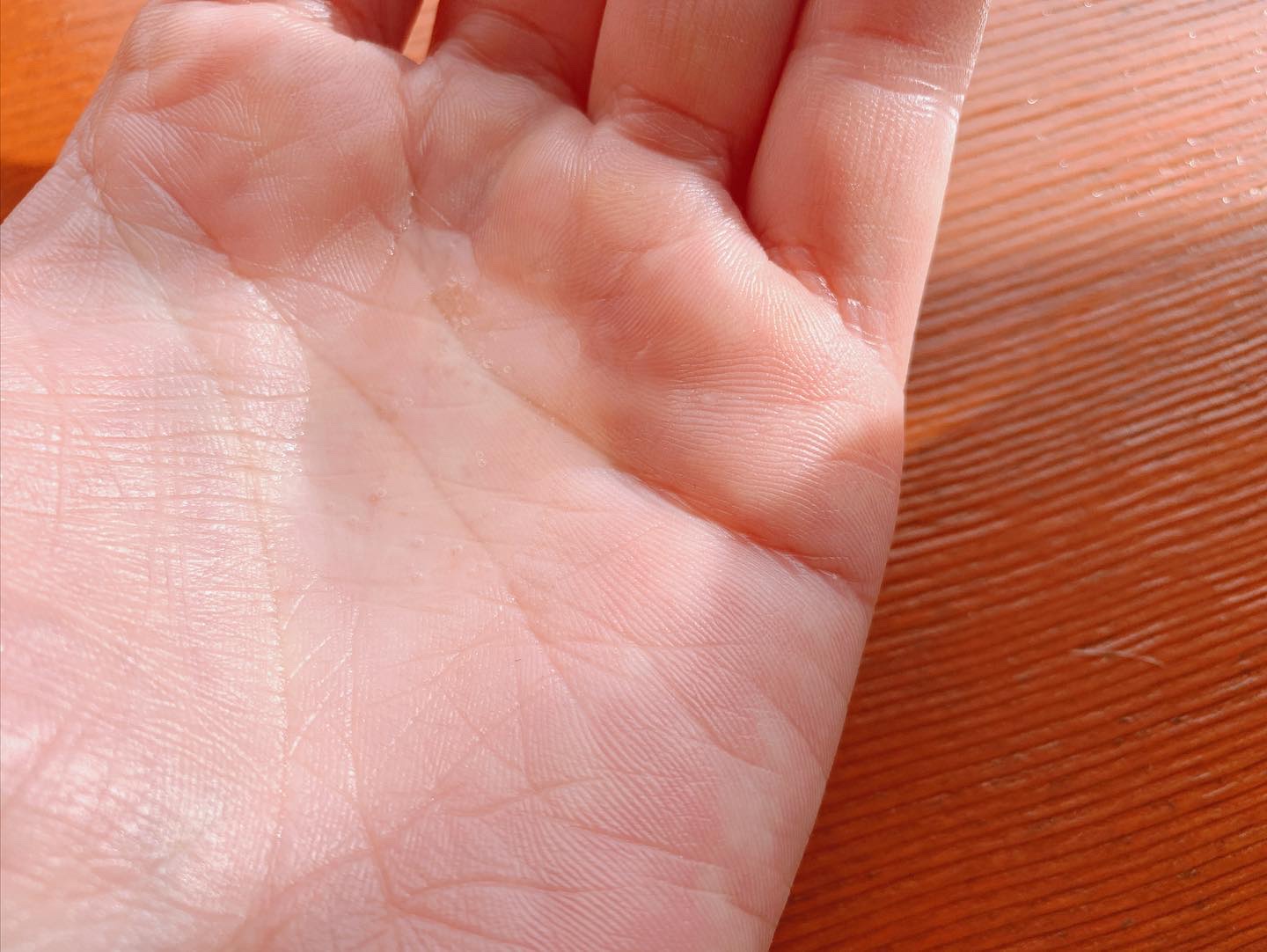 レッドボディーウォッシュ/MEDICUBE/ボディソープを使ったクチコミ（3枚目）