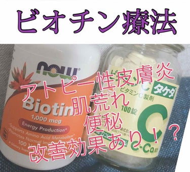 ビオチン/Now Foods/健康サプリメントを使ったクチコミ（1枚目）