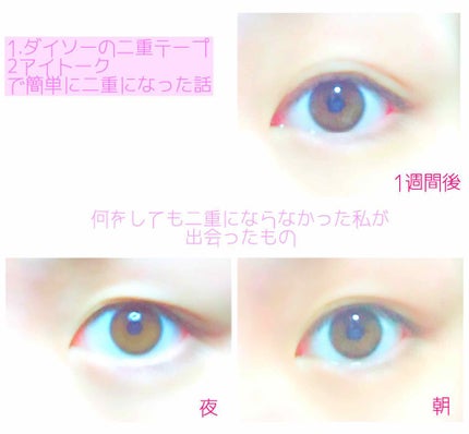 アイトーク/アイトーク/二重まぶた用アイテムを使ったクチコミ(1枚目)
