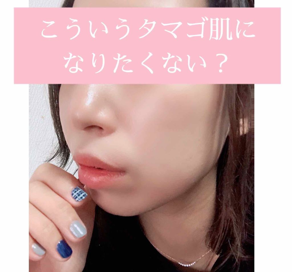 ペアアクネクリームW(医薬品)/ペア/その他を使ったクチコミ(1枚目)