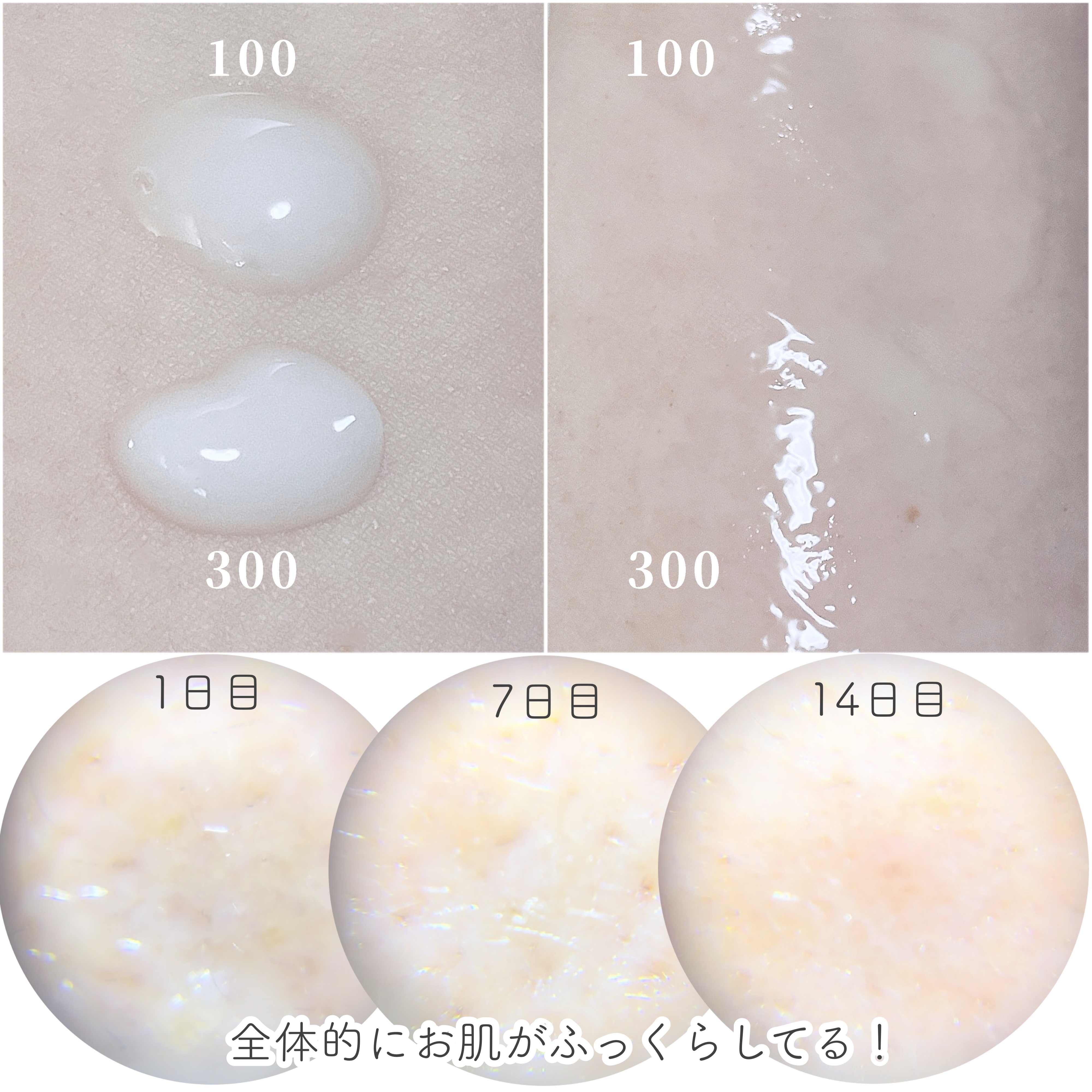 リードルショット100/VT/美容液を使ったクチコミ（2枚目）