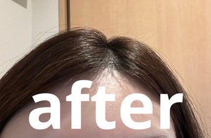 アイデイト まとめ髪ブラシa/IDATE/その他スタイリングを使ったクチコミ(3枚目)