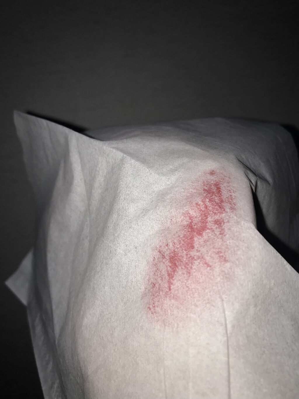 【旧】ディオール アディクト ステラー グロス 759 ディオールマニア/Dior/リップグロスを使ったクチコミ（2枚目）