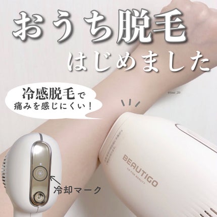 サファイアIPL脱毛器 /yete/家庭用脱毛器を使ったクチコミ(1枚目)