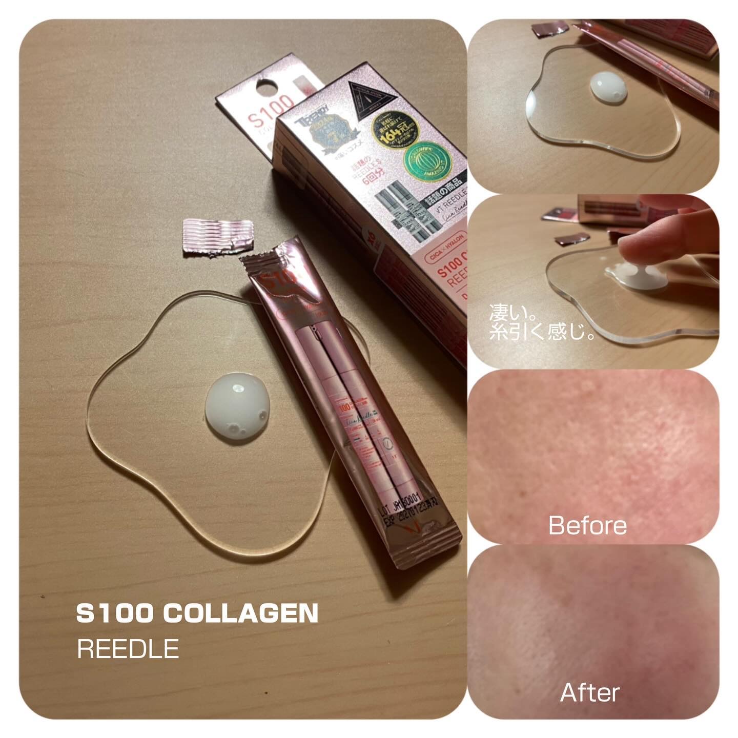 リードルS 100 2ステップマスク/VT/シートマスク・パックを使ったクチコミ（2枚目）