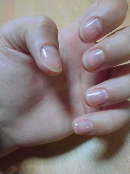 AT トップ&ベースコート/Art Collection/ネイルトップコートを使ったクチコミ(4枚目)