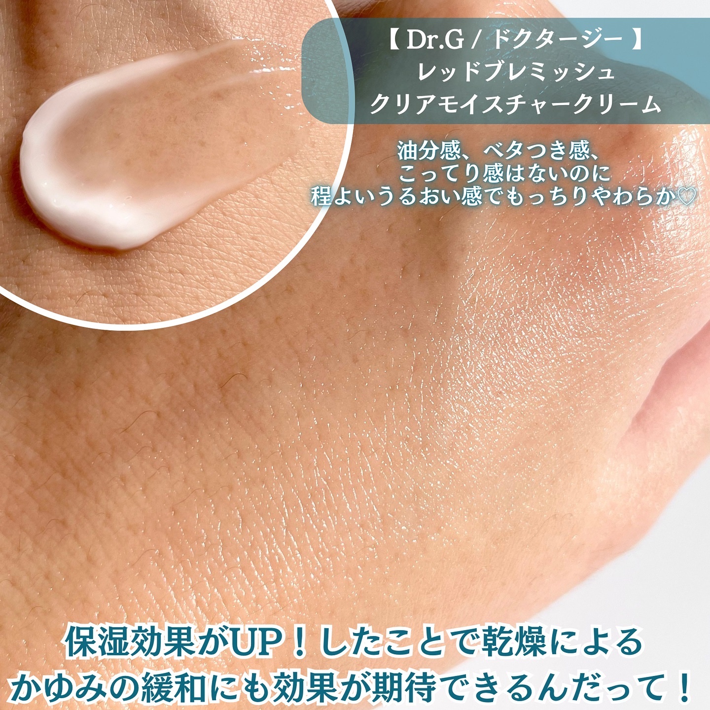 レッドブレミッシュ クリアスージングクリーム/Dr.G/フェイスクリームを使ったクチコミ（3枚目）