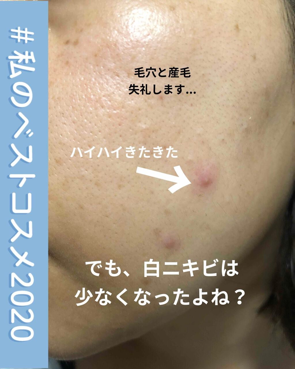 肌をうるおす保湿クリーム/肌をうるおす保湿スキンケア/フェイスクリームを使ったクチコミ(3枚目)