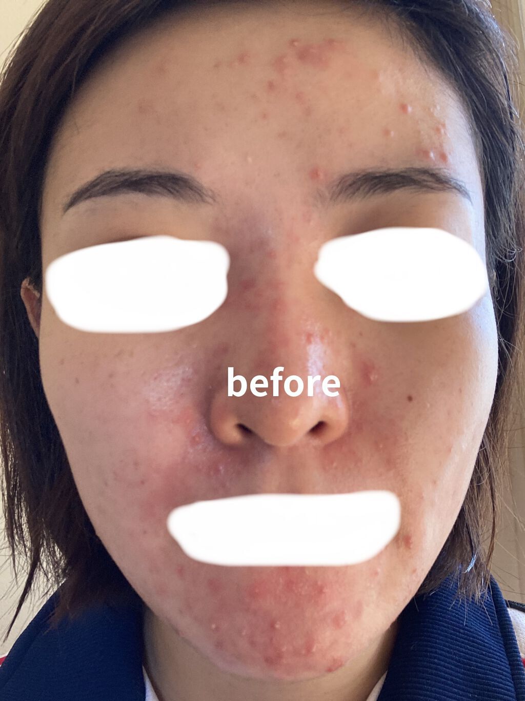 UVイデア XL プロテクショントーンアップ/ラ ロッシュ ポゼ/日焼け止めクリームを使ったクチコミ（1枚目）