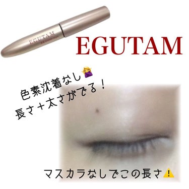 ⚠️まつげが絶対に伸びます⚠️
【EGUTAM】

マツエクを辞めたくて、5年前にまつ毛育毛を始めました👀
沢山試して、口コミを見て、たどり着いたのがEGUTAMです✨
EMAKEDとメーカーや流通が違