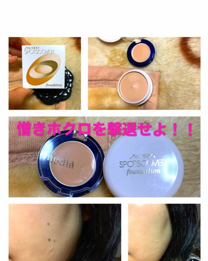 スポッツカバー ファウンデイション/SHISEIDO/クリームコンシーラーを使ったクチコミ(1枚目)