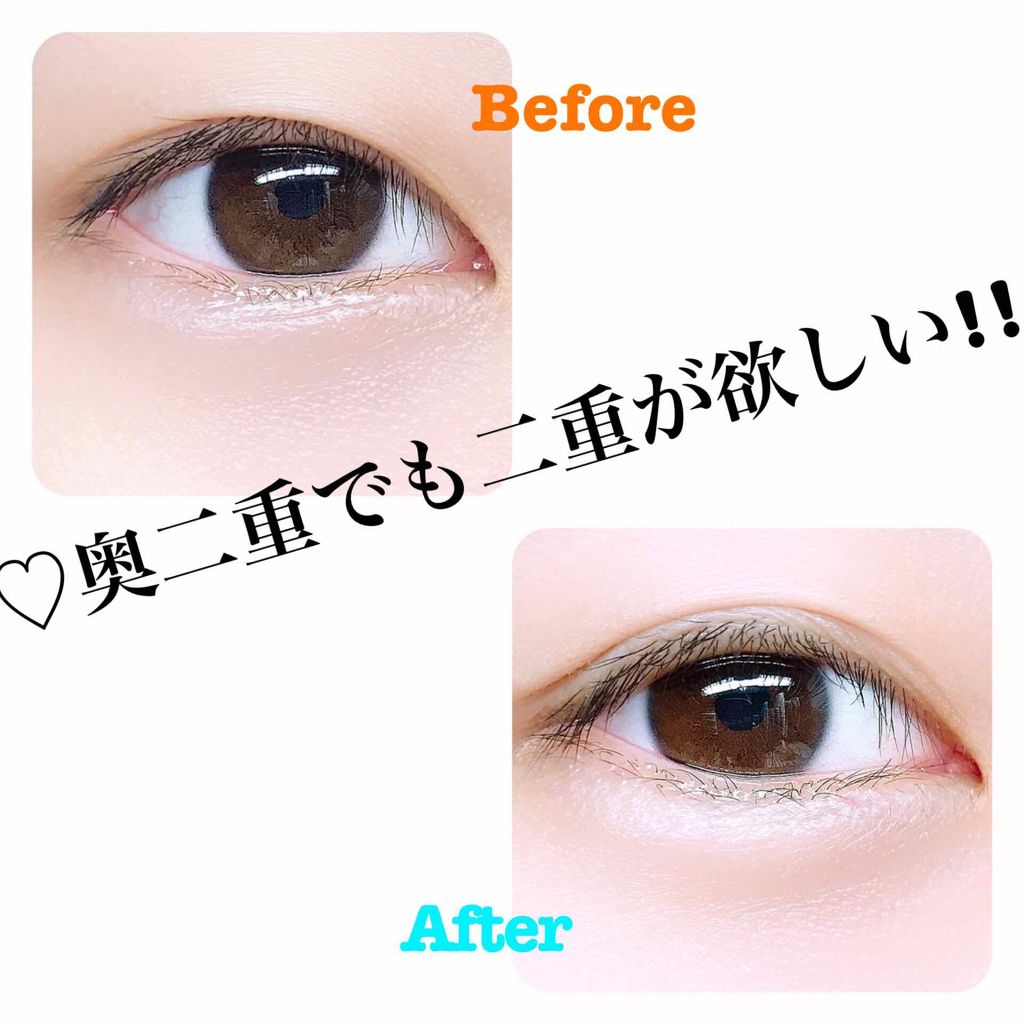 のびーるアイテープ（絆創膏タイプ、レギュラー）/DAISO/二重まぶた用アイテムを使ったクチコミ（1枚目）