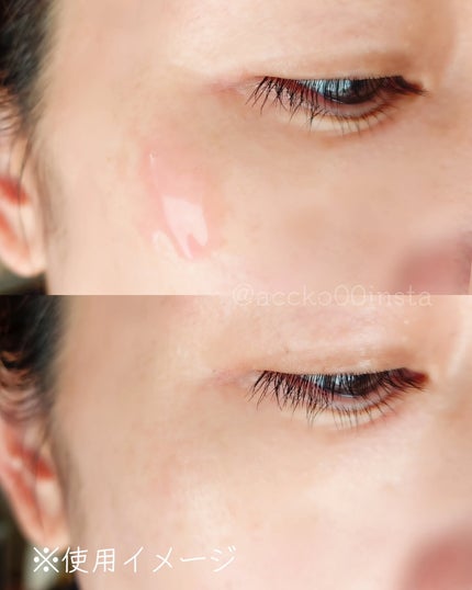 PDRNピンクアンプル PDRN 10,000ppm配合/MEDICUBE/美容液を使ったクチコミ(6枚目)