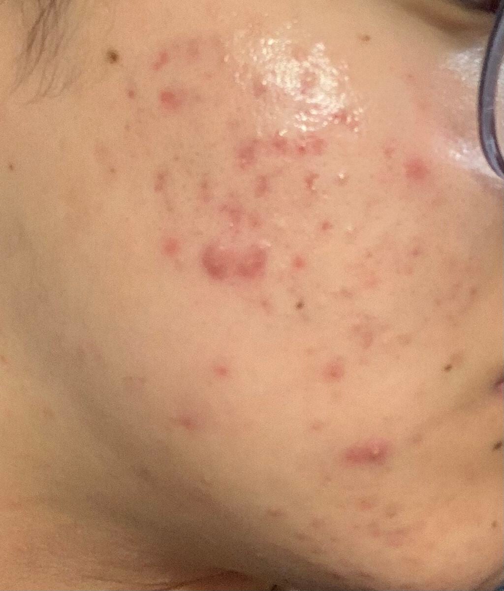 デュオ ザ 薬用クレンジングバーム バリア【医薬部外品】/DUO/クレンジングバームを使ったクチコミ(1枚目)