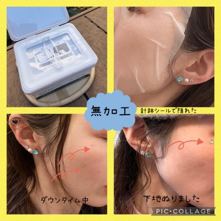 レッドブレミッシュクイックPHAシートマスク/Dr.G/シートマスク・パックを使ったクチコミ(2枚目)