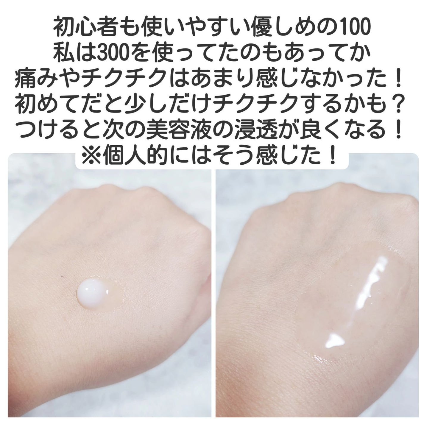 リードルショット100/VT/美容液を使ったクチコミ(4枚目)