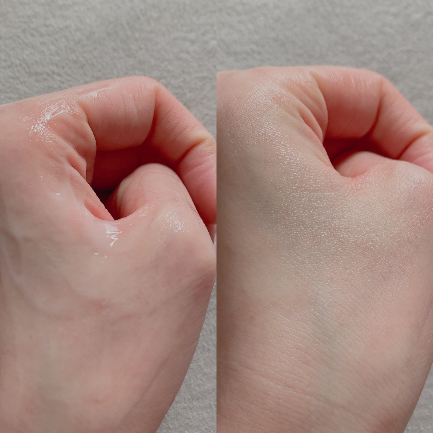 レッドブレミッシュ クリアスージングクリーム/Dr.G/フェイスクリームを使ったクチコミ(3枚目)