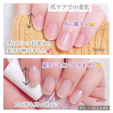アロマ キューティクルオイル D Upを使った口コミ 今年の初めボロボロだった爪が半年でピカピカ By みぃこ 混合肌 Lips