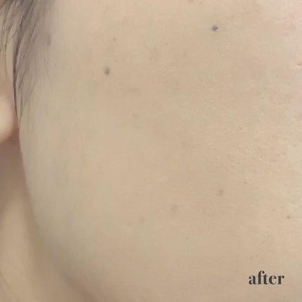 マーシュフィールド SC クリームファンデS/マーシュ・フィールド/クリーム・エマルジョンファンデーションを使ったクチコミ(7枚目)