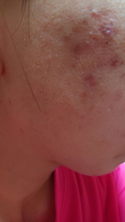 を使ったクチコミ(1枚目)