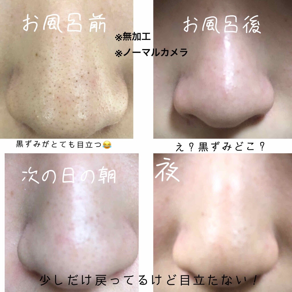 ニベアクリーム/ニベア/ボディクリームを使ったクチコミ（2枚目）