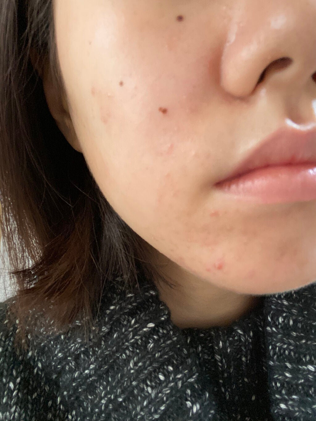 aya on LIPS 「お久しぶりです❕べピオゲル塗ってから1週間後...と言う話でし..」(2枚目)