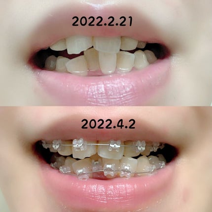 コンクールF/ウエルテック/マウスウォッシュ・スプレーを使ったクチコミ(7枚目)