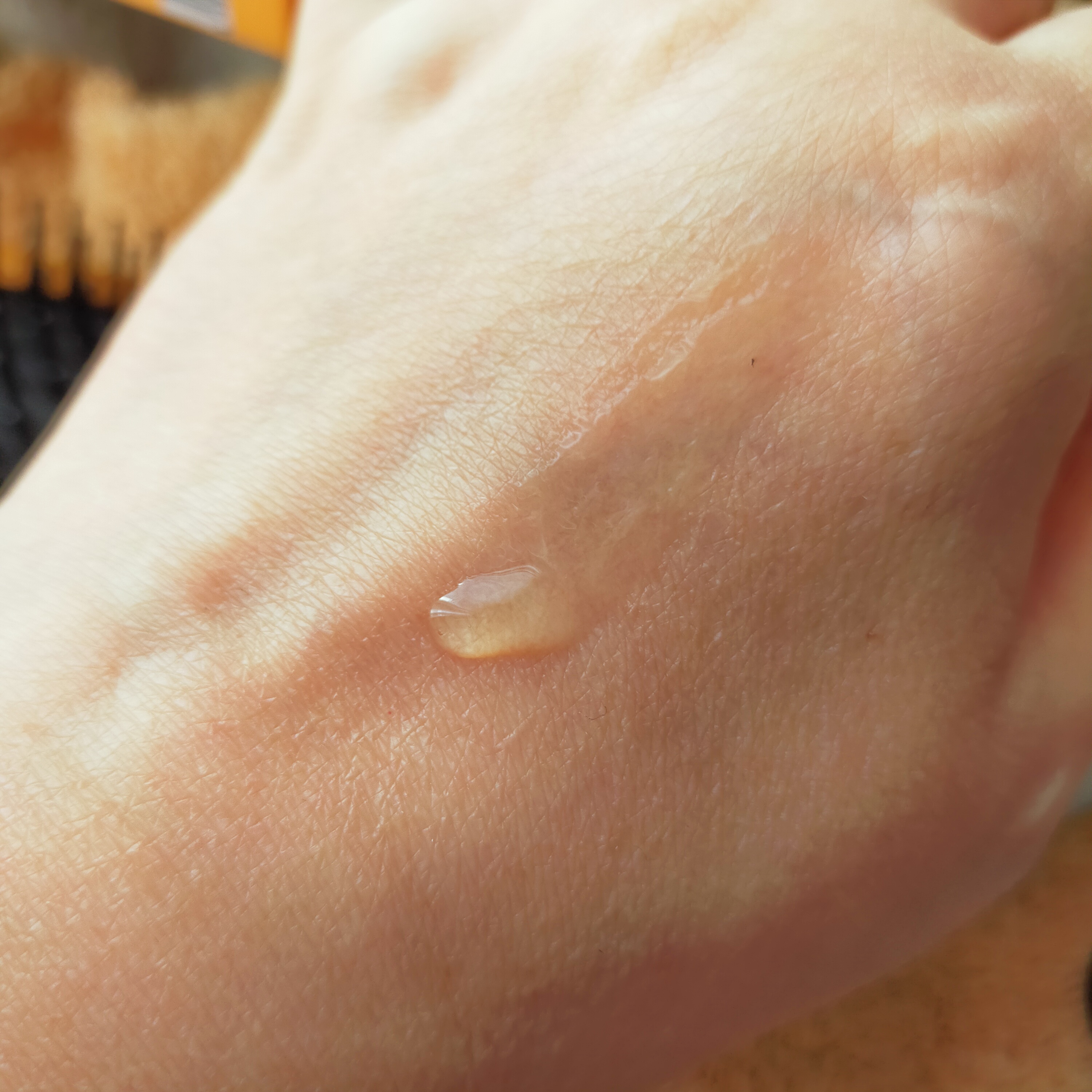 リ・ヘアスパ ボリュームエッセンスジェル/La ViLLA ViTA/頭皮ローションを使ったクチコミ（2枚目）