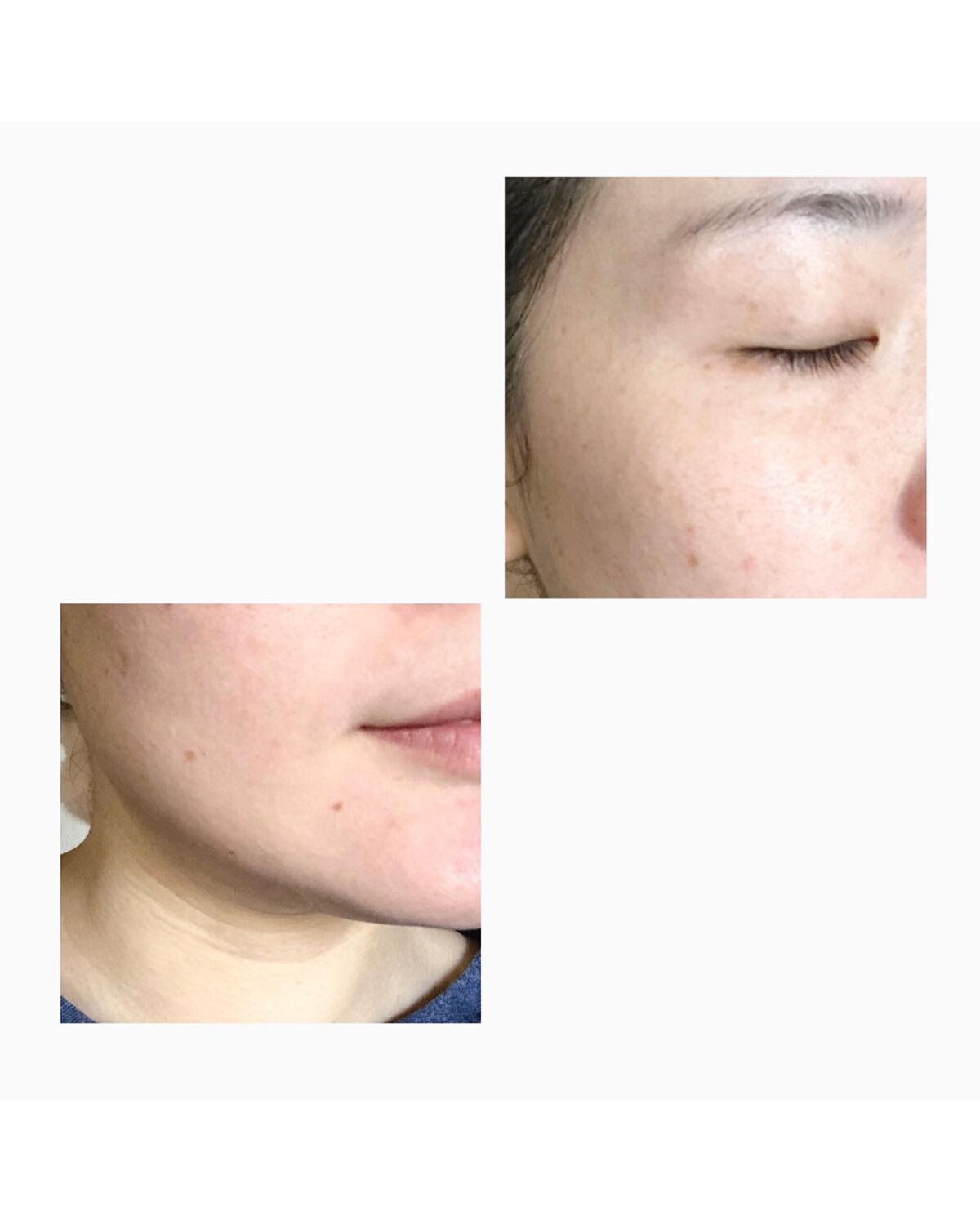 エリクシール シュペリエル エンリッチド リンクルクリーム/エリクシール/アイケア・アイクリームを使ったクチコミ(4枚目)