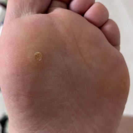 べっぴんはとむぎ/タマチャンショップ/食品を使ったクチコミ(7枚目)