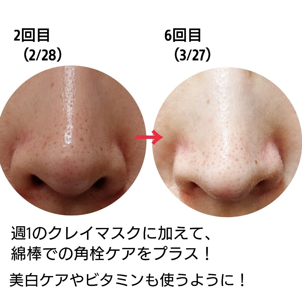 スーパーヴォルカニック ポアクレイマスク 2x Innisfreeの効果に関する口コミ 毛穴日記 週1のクレイマスクに加えて 綿 By ふるゆき 混合肌 代前半 Lips