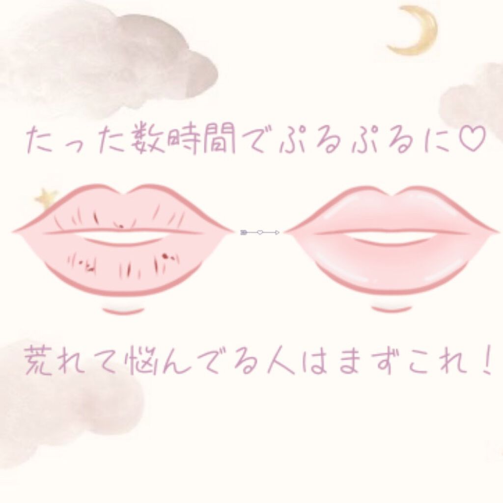 メンソレータム薬用リップ Hfca/メンソレータム/リップクリームを使ったクチコミ(1枚目)