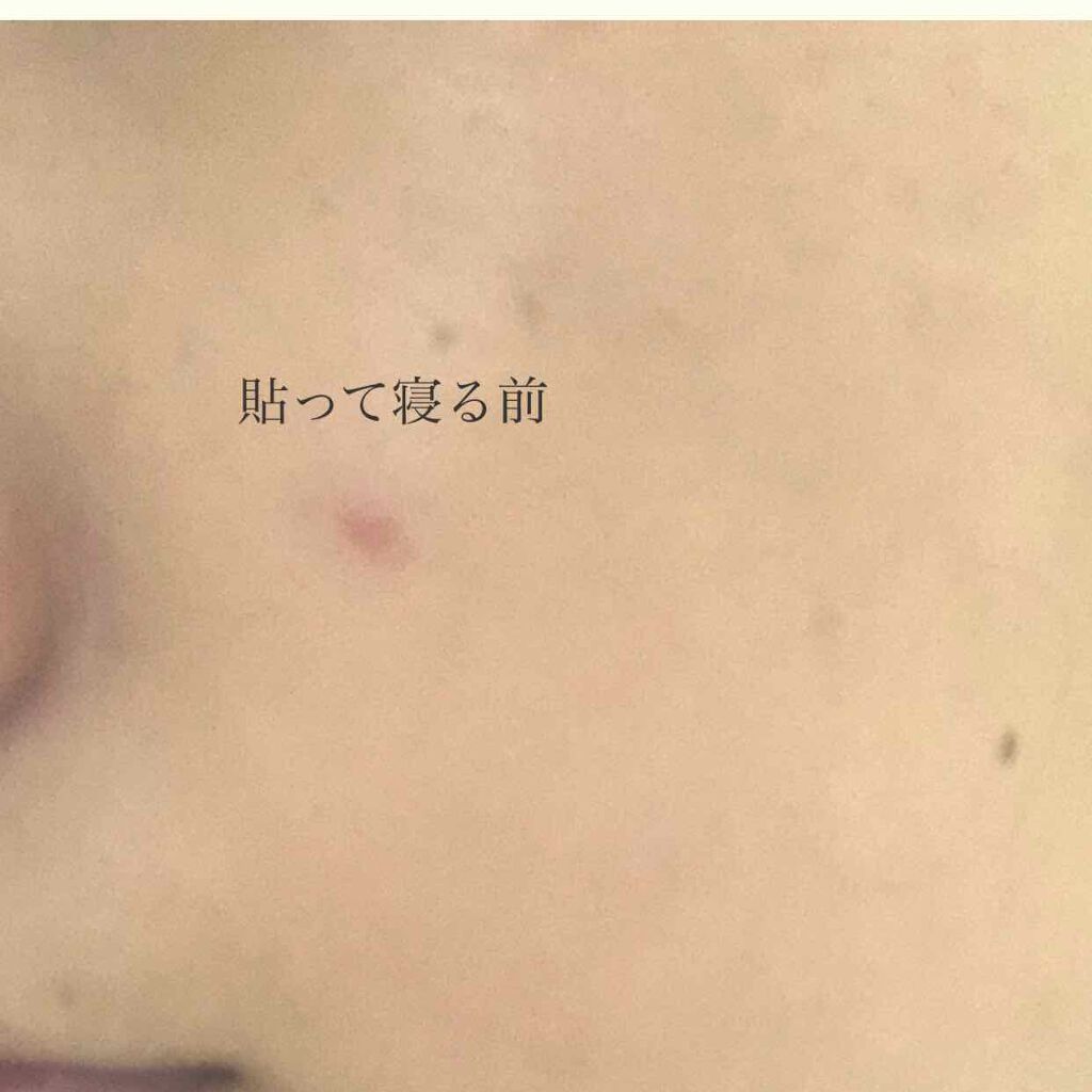 トラブルキュア/美肌ファクトリー/シートマスク・パックを使ったクチコミ(2枚目)