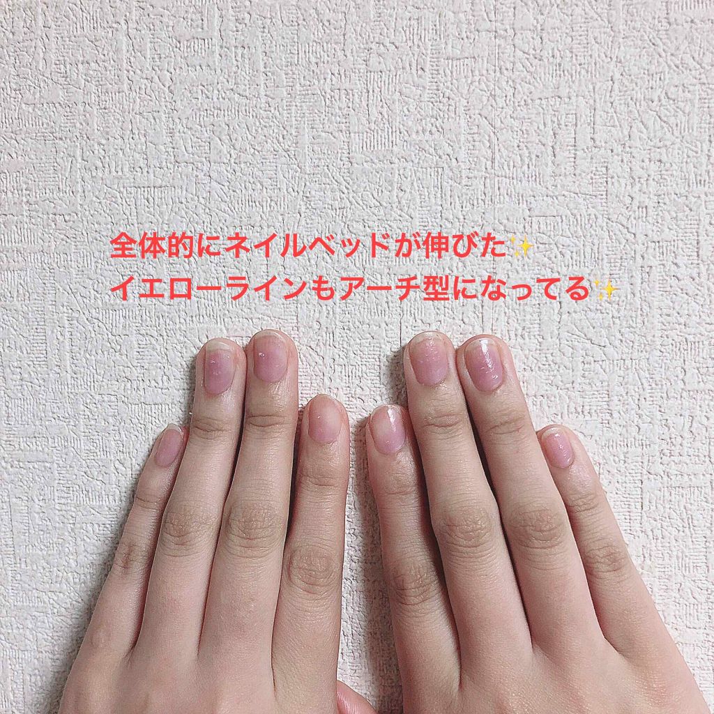 プロスパ ネイル キューティクルオイル トゥゴー O P Iの口コミ ネイルケアを始めて約1ヵ月半かなり爪に変化 By リンドウ 混合肌 代前半 Lips
