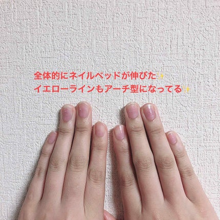 プロスパ ネイル&キューティクルオイル トゥゴー/O・P・I/ネイルオイル・トリートメントを使ったクチコミ(3枚目)