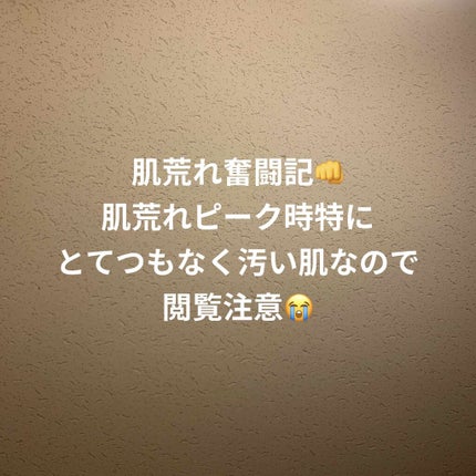 ミノン アミノモイスト モイストチャージ ミルク/ミノン/乳液を使ったクチコミ(1枚目)