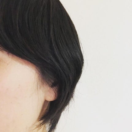 薬用スカルプセラム/wicot/頭皮ローションを使ったクチコミ(9枚目)