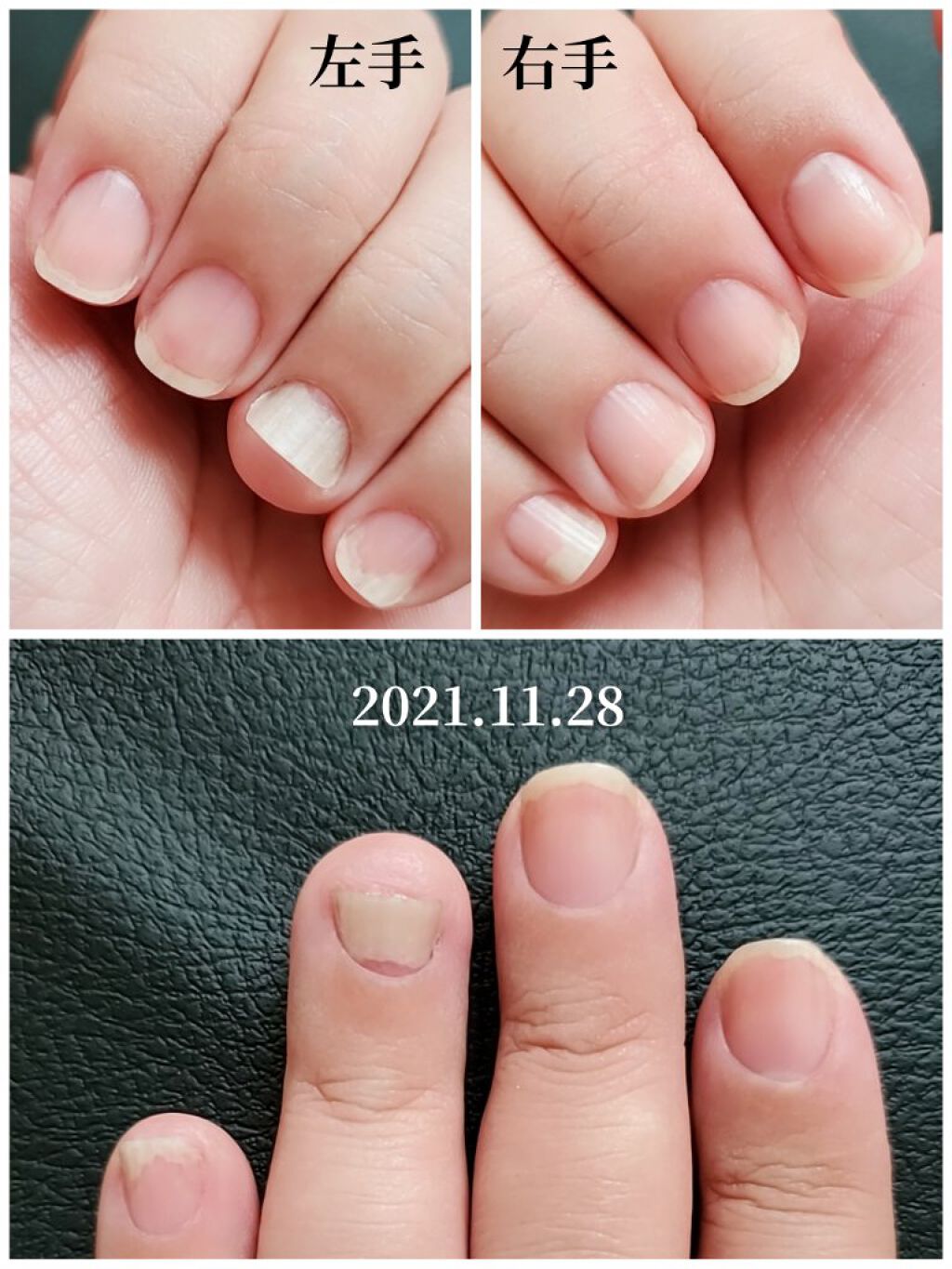 ネイルベッドオイル/アンドネイル/ネイルオイル・トリートメントを使ったクチコミ（2枚目）