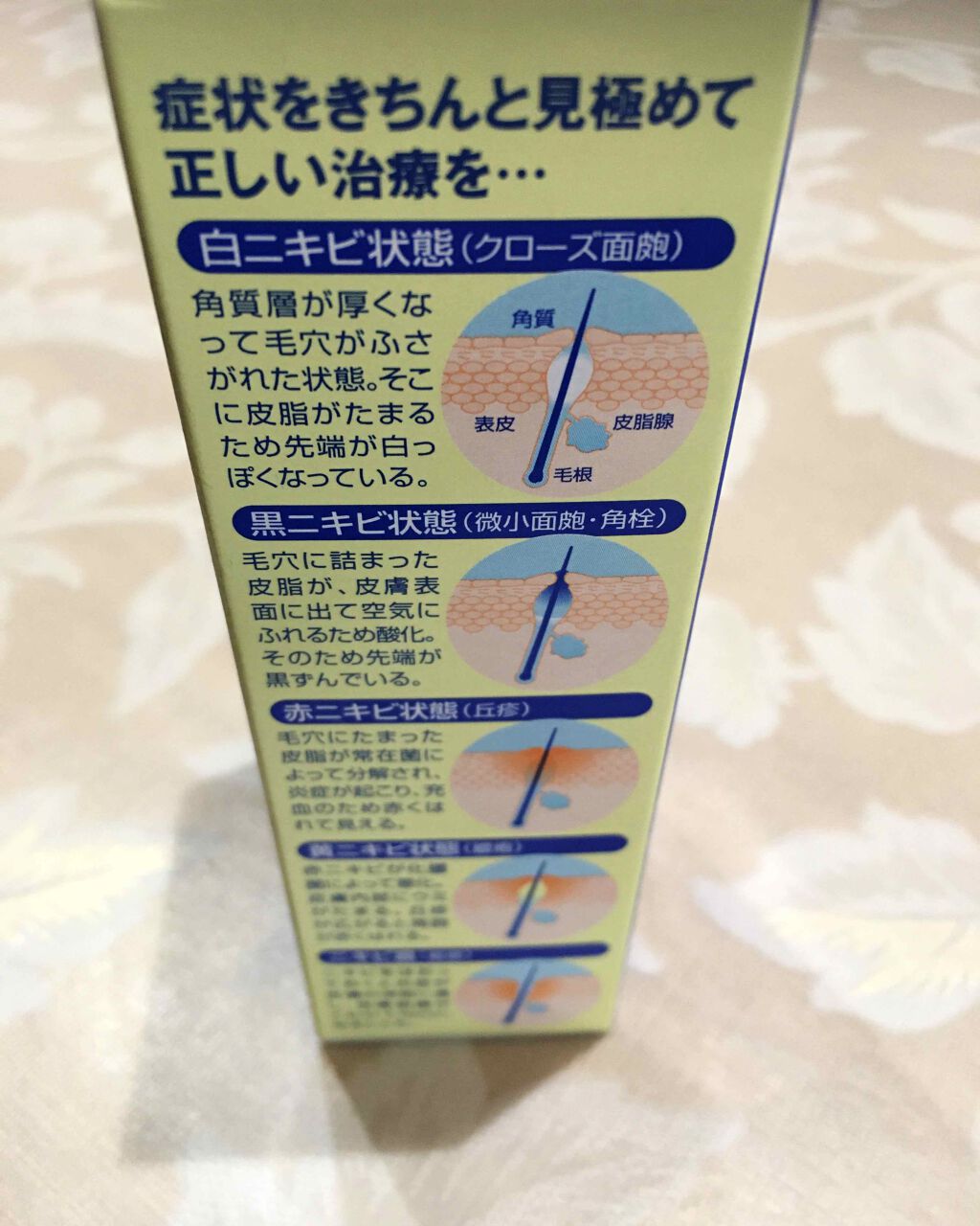 303円 熱販売 メンターム アクネローション 110mL 1個 第2類医薬品 303円 熱販売 メンターム アクネローション 110mL 1個 第2類医薬品