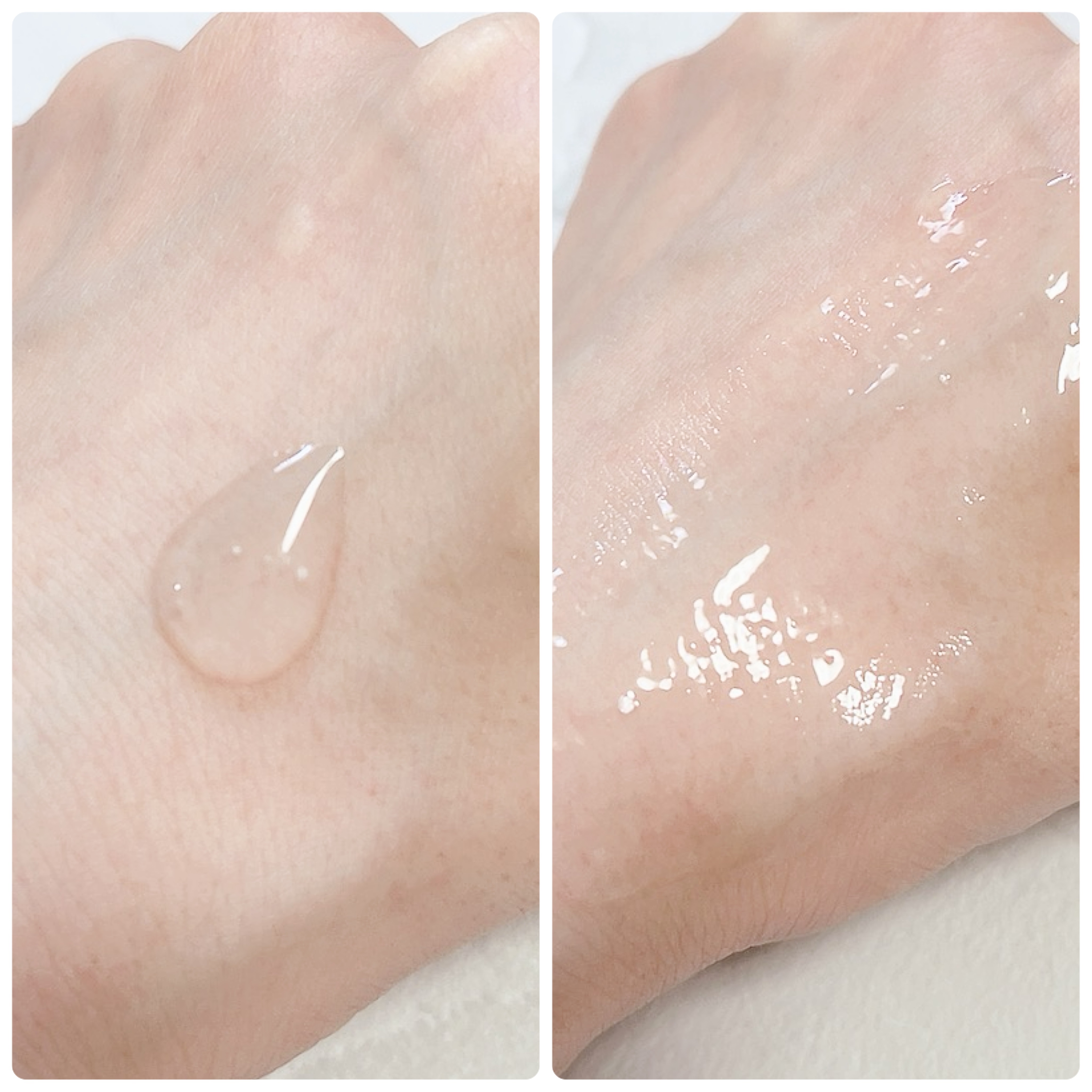 ナイアシンジンクビーズセラム/Frankly/美容液を使ったクチコミ（3枚目）