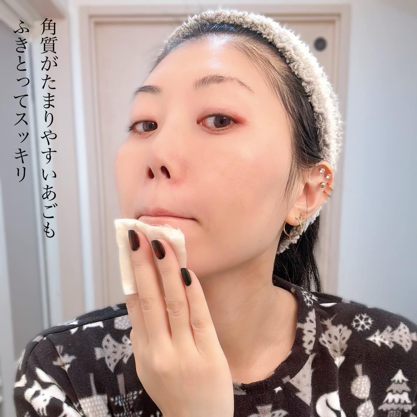 オードムーゲ 薬用ローション(ふきとり化粧水)/オードムーゲ/拭き取り化粧水を使ったクチコミ(6枚目)