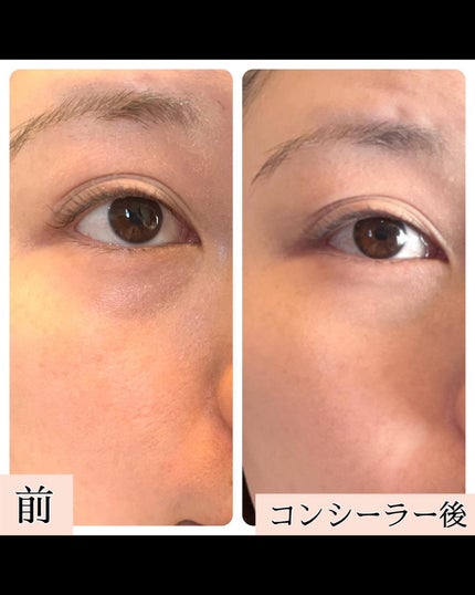 グロウイングトリートメントリクイド/LUNASOL/リキッドファンデーションを使ったクチコミ(5枚目)