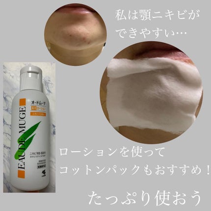オードムーゲ 薬用ローション(ふきとり化粧水)/オードムーゲ/拭き取り化粧水を使ったクチコミ(4枚目)