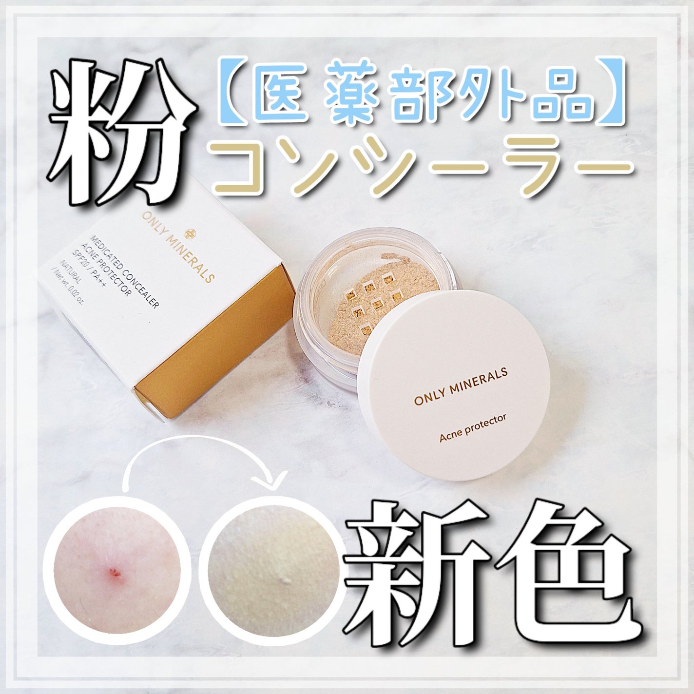 薬用コンシーラー アクネプロテクター/ONLY MINERALS/パウダーコンシーラーを使ったクチコミ(1枚目)