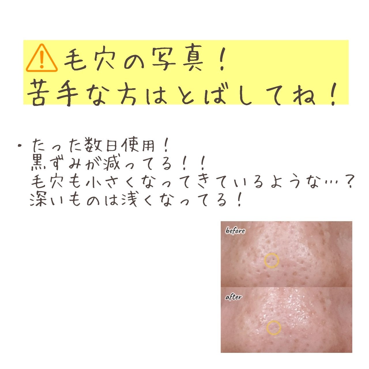 ポアフィットウォータートナー/Feld Apotheke/化粧水を使ったクチコミ(7枚目)