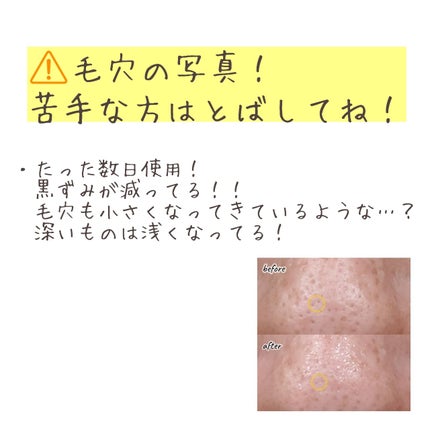 ポアフィットウォータートナー/Feld Apotheke/化粧水を使ったクチコミ(7枚目)