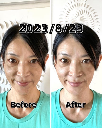 エクスイディアル オーヴォ/エクスイディアル/美顔器・マッサージを使ったクチコミ(4枚目)