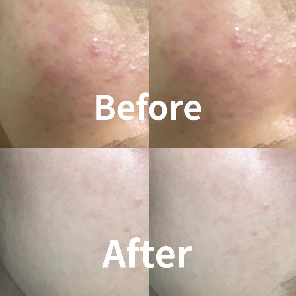 明色美顔水 薬用化粧水/美顔/化粧水を使ったクチコミ(3枚目)