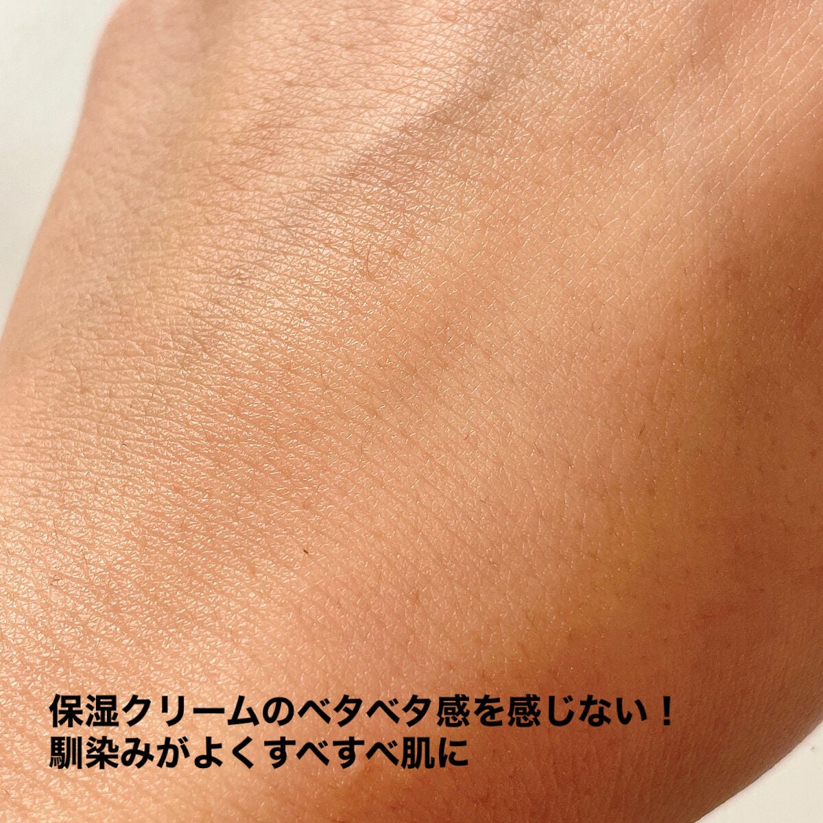 ヘパトリート 薬用保湿ミルククリーム/ゼトックスタイル/ボディクリームを使ったクチコミ(5枚目)