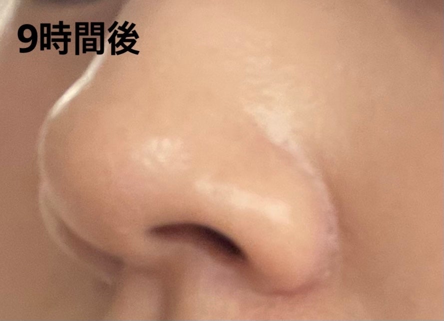 ブラック クッション/HERA/クッションファンデーションを使ったクチコミ(4枚目)